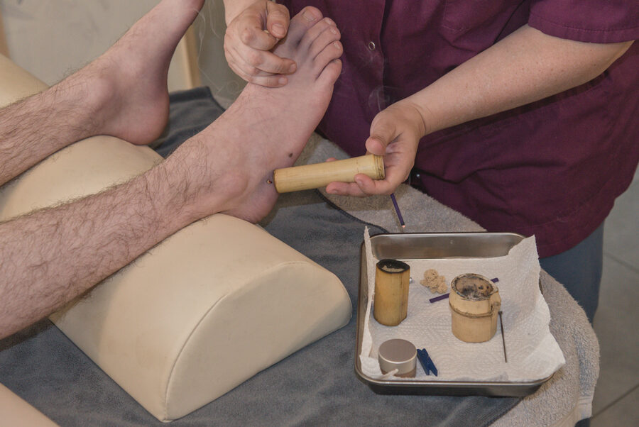 Moxibustion pour renforcer l'énergie en médecine chinoise