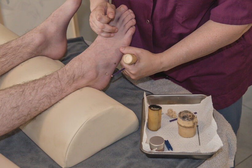 Moxibustion japonaise